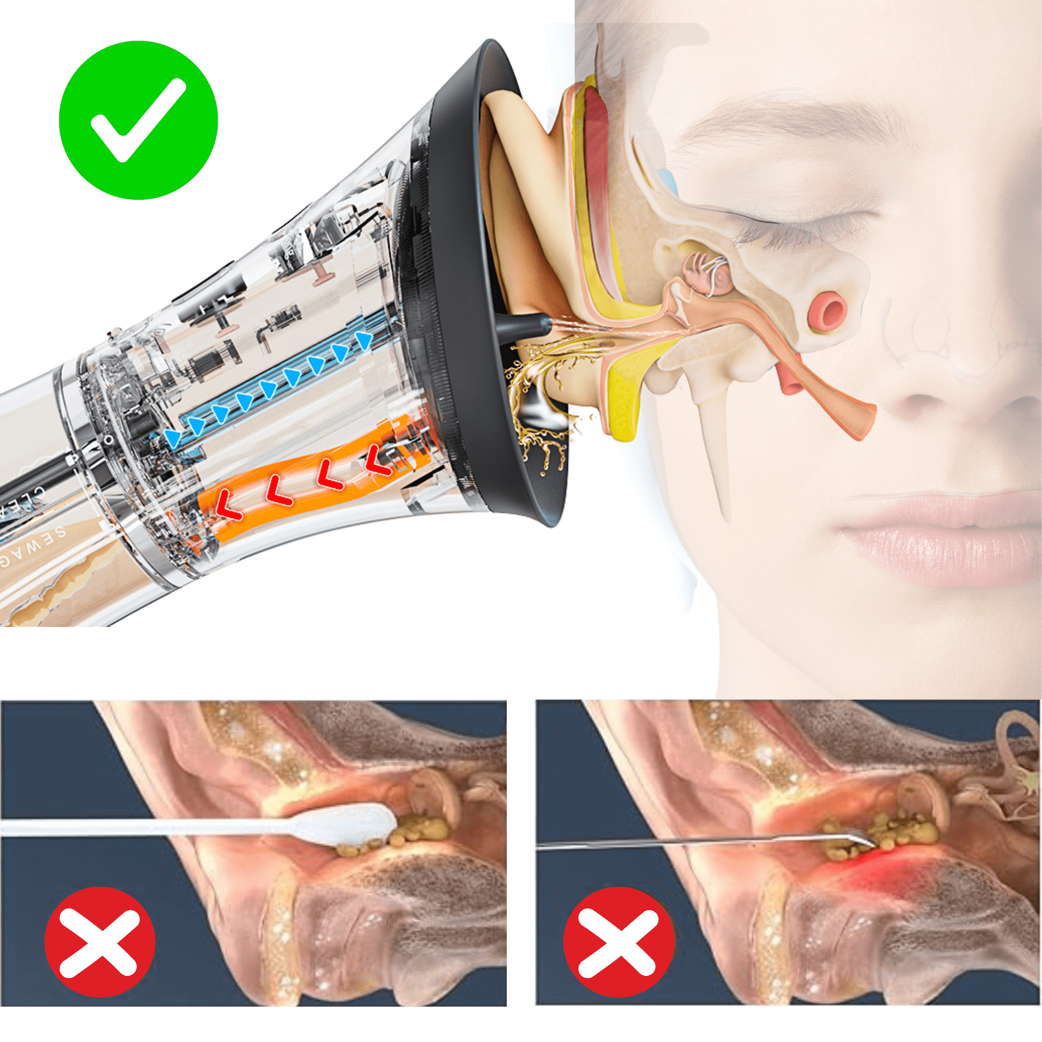 Ear Wax Remover