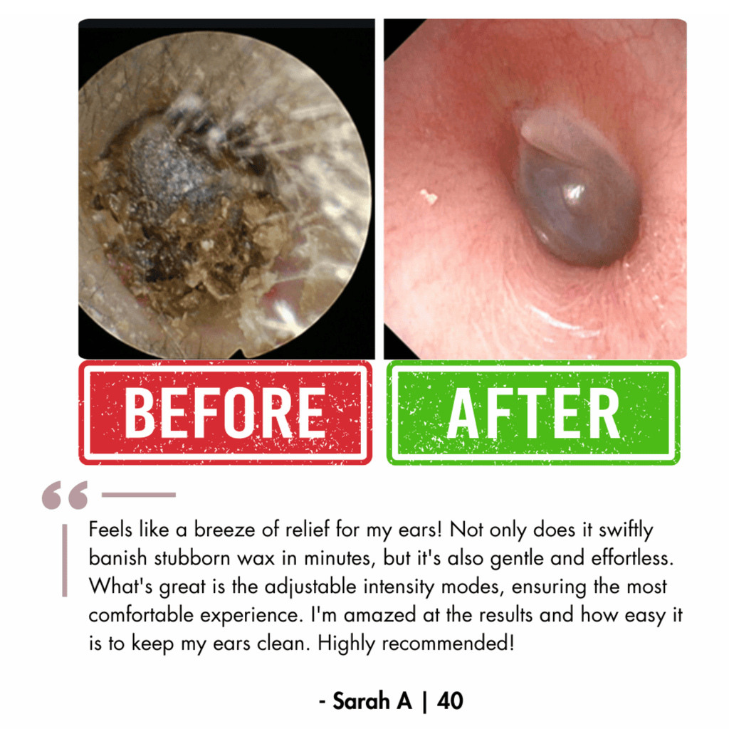 Ear Wax Remover