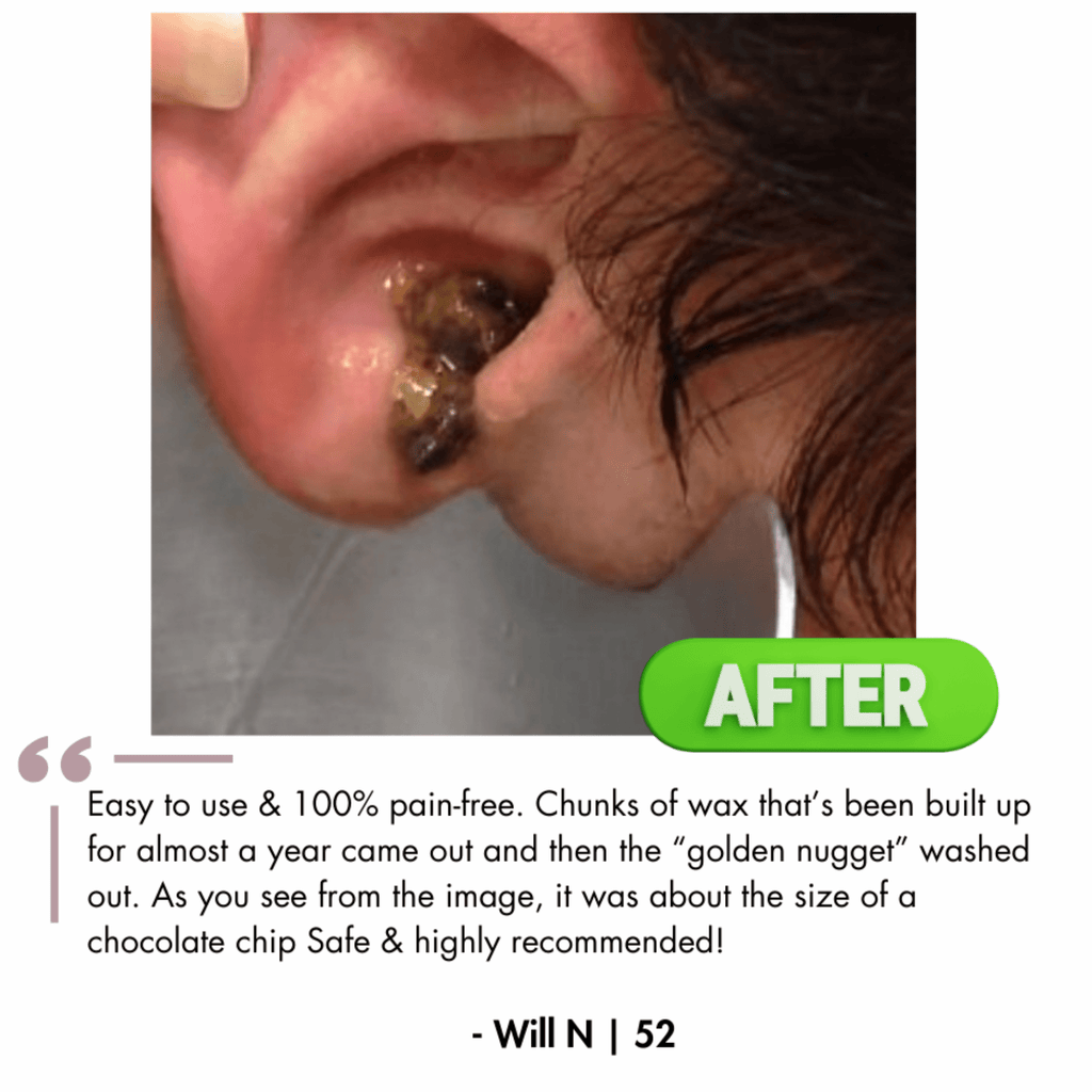 Ear Wax Remover